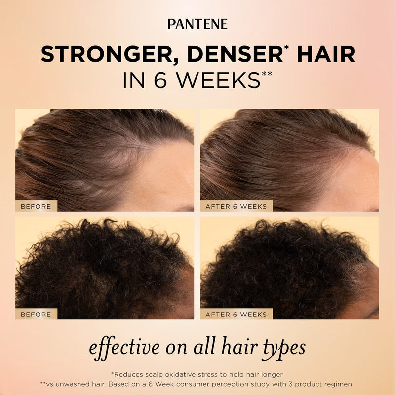Pantene Abundant & Strong Scalp & Root Hair Serum with Niacinamide 2 oz