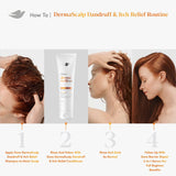 Dove Derma Scalp Dandruff & Itch Relief Conditioner with Pyrithione Zinc, Lamellar Serum and Niacinamide or Flaky, Itchy Scalp Relief 9 fl oz 1 Count