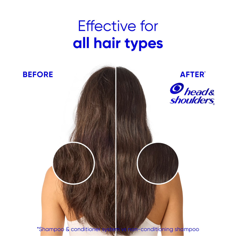 Head and Shoulders 2 in 1 Dandruff Shampoo and Conditioner, Hydrating Coconut, 28.2 fl oz