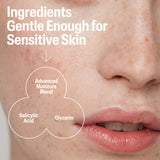 Cetaphil Gentle Clear Pore Clearing Acne Cleanser for Sensitive, Acne-Prone Skin, 8 fl oz