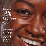 Olay Vitamin C Brightening Light Weight Moisturizer, Hydrates & Evens Tone, 1.7 oz