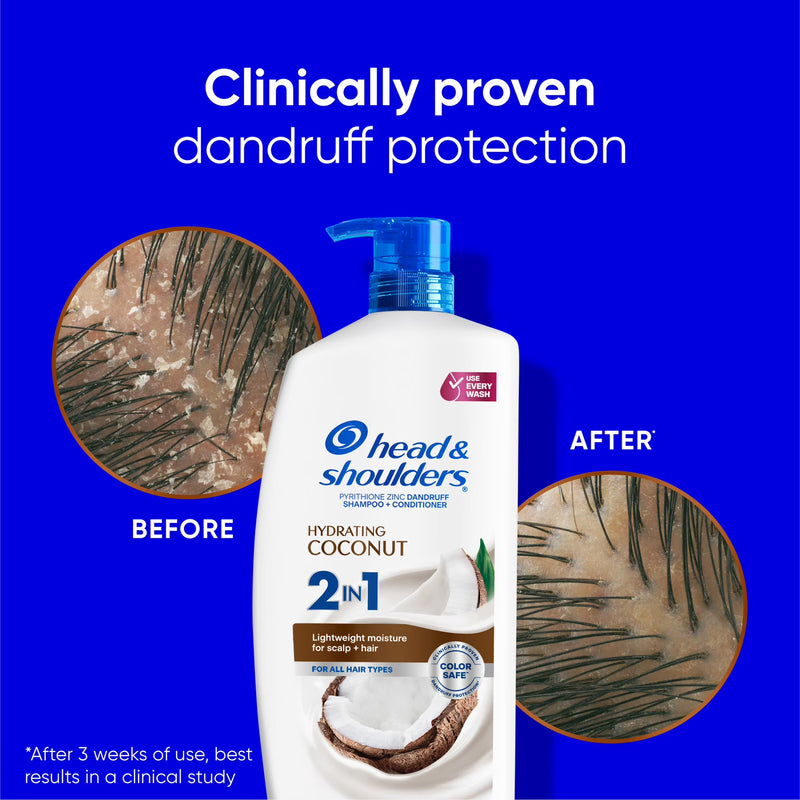 Head and Shoulders 2 in 1 Dandruff Shampoo and Conditioner, Hydrating Coconut, 28.2 fl oz