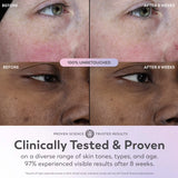 Olay Super Serum, 5-in-1 Skin Enhancing Face Serum, 1.0 oz, For Brightening Dull or Dry Skin